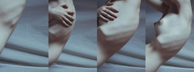 Eine Collage einer Frau mit Narben am Oberkörper.