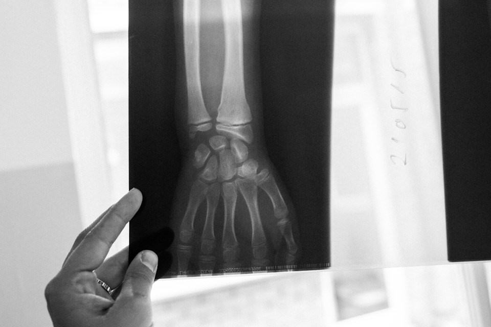 Röntgenfotografie einer Hand