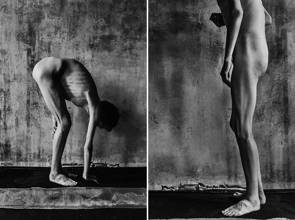 Eine Frau, nackt, dünn, vor einer Wand stehend. 