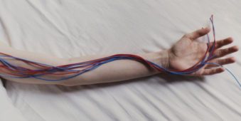 Rote und blaue Kabel liegen auf einem Arm.