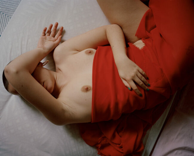 Eine Person liegt mit entblößter Brust auf einem Bett und hält den Arm über die Augen