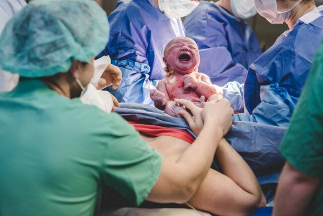 Neugeborenes beim Kaiserschnitt